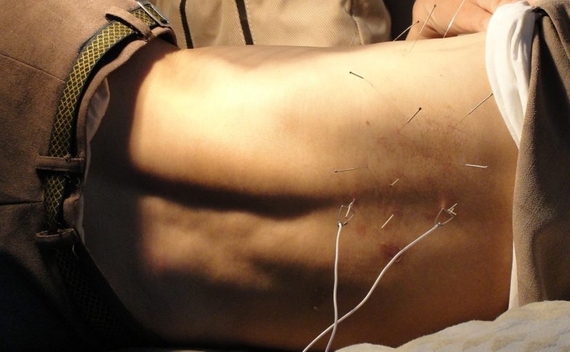 Acupuncture Training