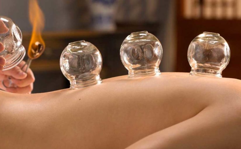 Acupuncture and Oriental Medicine